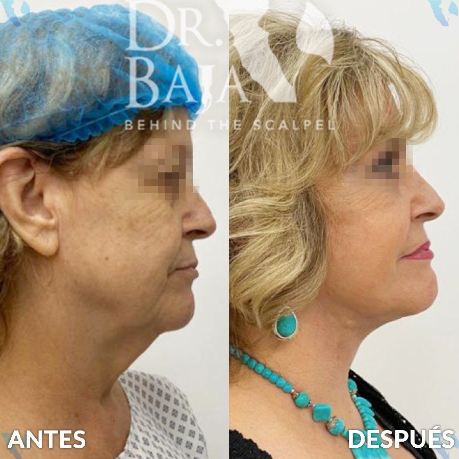 Renato Rodríguez Hirales-11