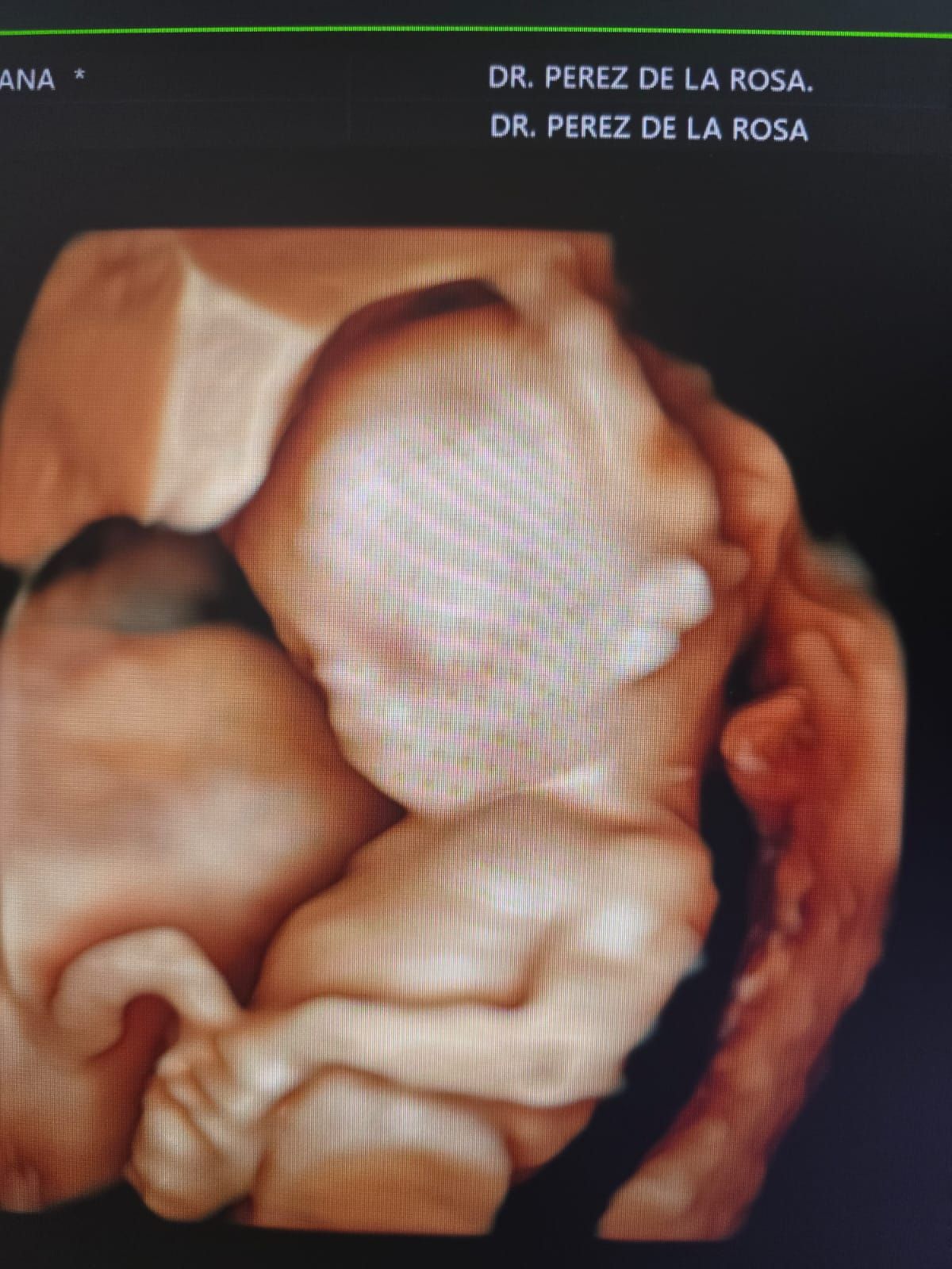 Abraham Ignacio Pérez De La Rosa-3