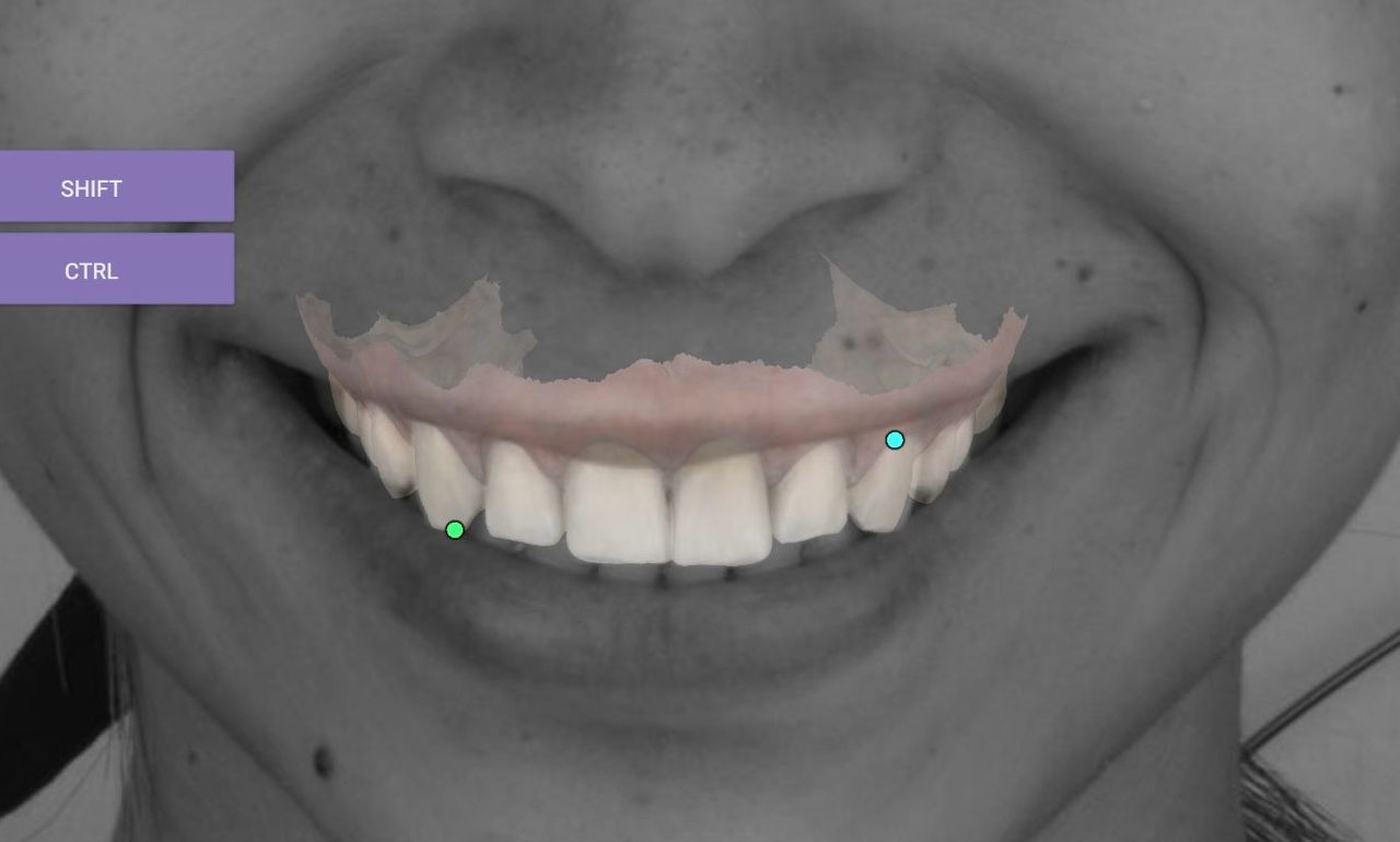 Fredy Alejandro Roblero Gónzalez-30