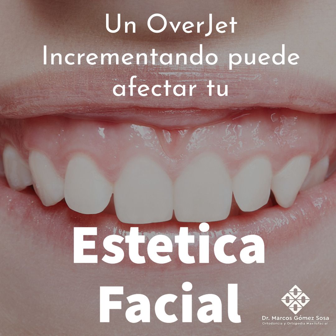 Marcos Gómez Sosa-36