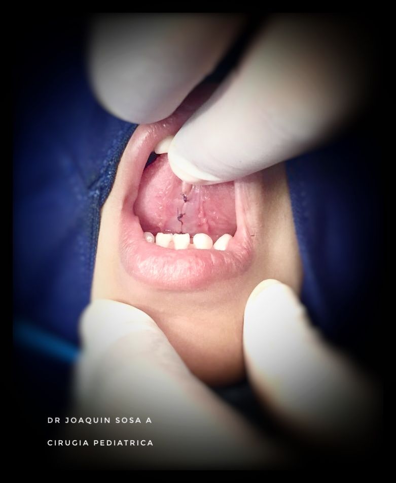 R. Joaquín Sosa Azcorra-16