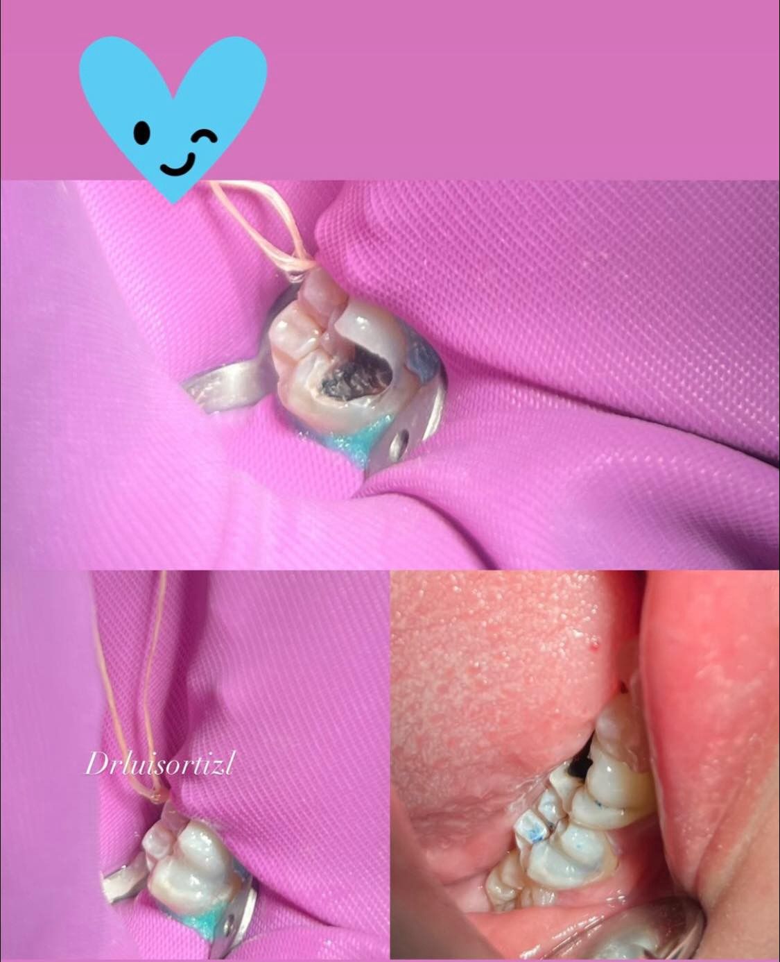 Luis Ángel Ortiz López-19