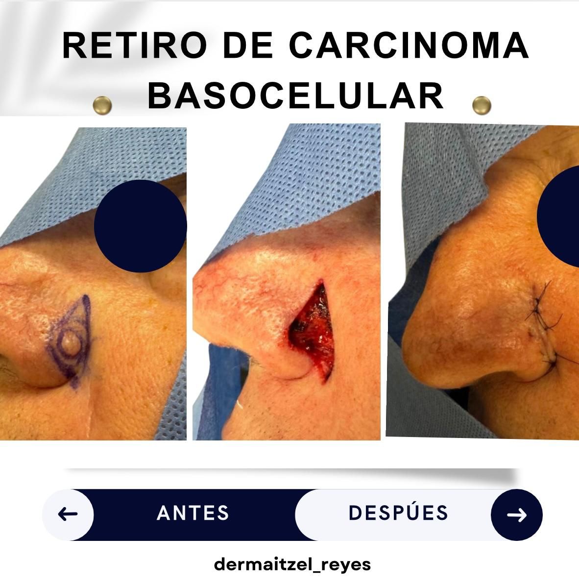 Itzel Anayn Flores Reyes-14