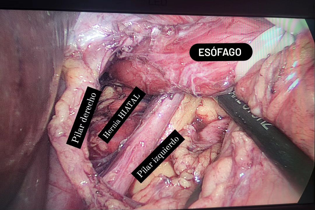 Wiron R. Valladares Valladares-1