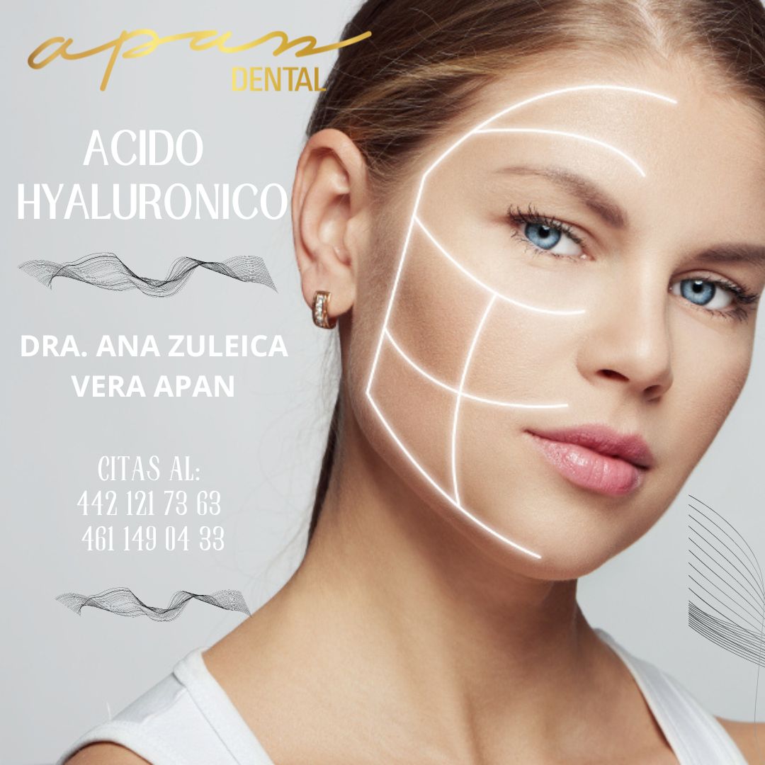 Zuleica Vera Apan-22