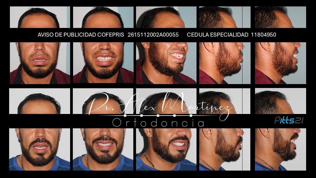 Alejandro Martínez Hernández-10