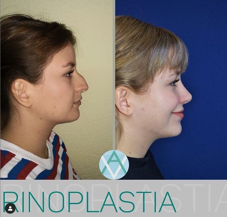 Alfonso Villaseñor Herrero-1