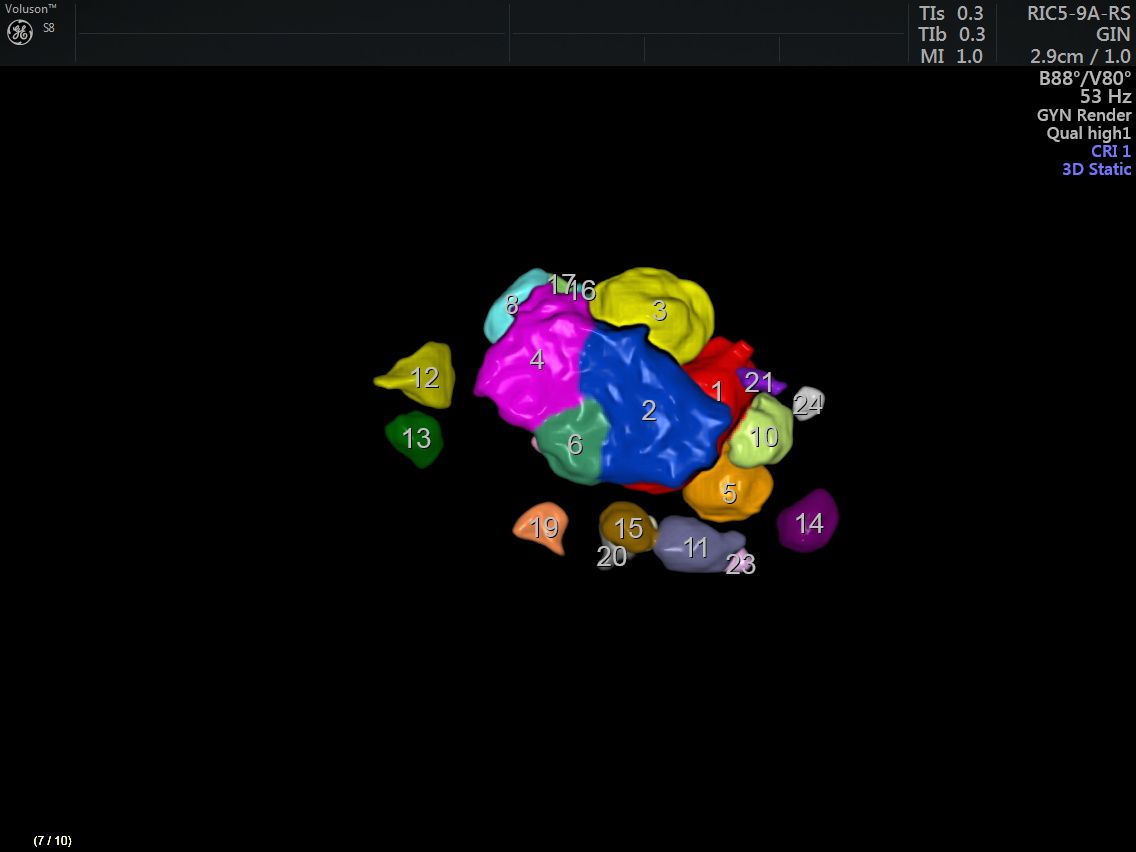 Griselda Reyes Torres-83