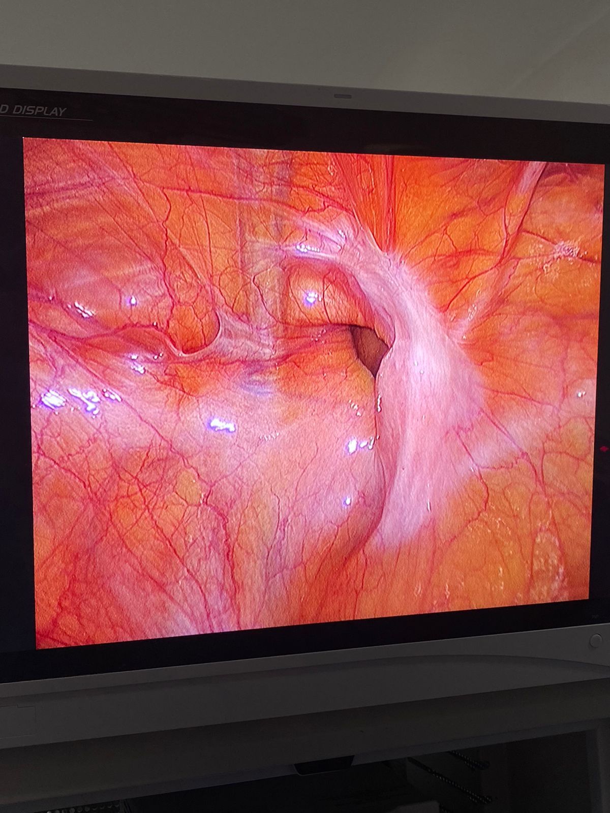 Luis Angel Medina Andrade-24