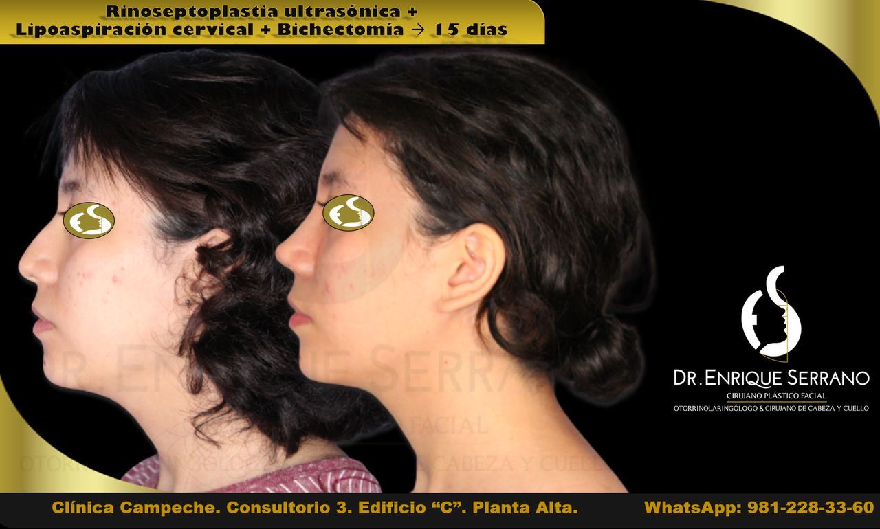 Enrique Serrano Cruz-21