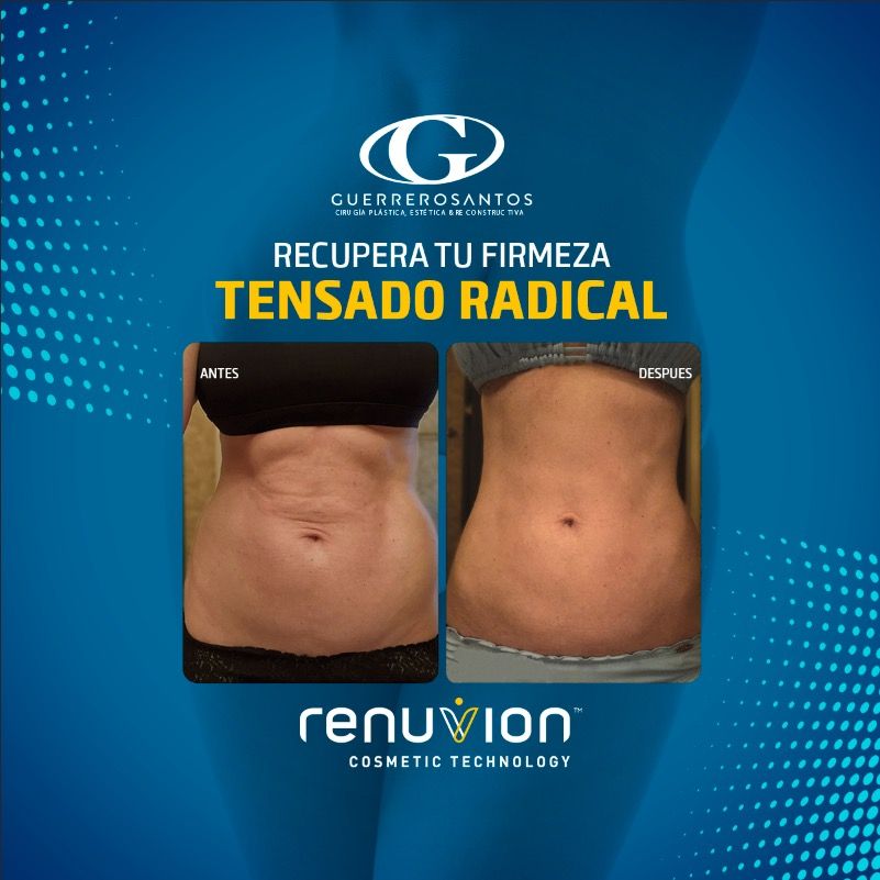 Fernando Guerrerosantos-24