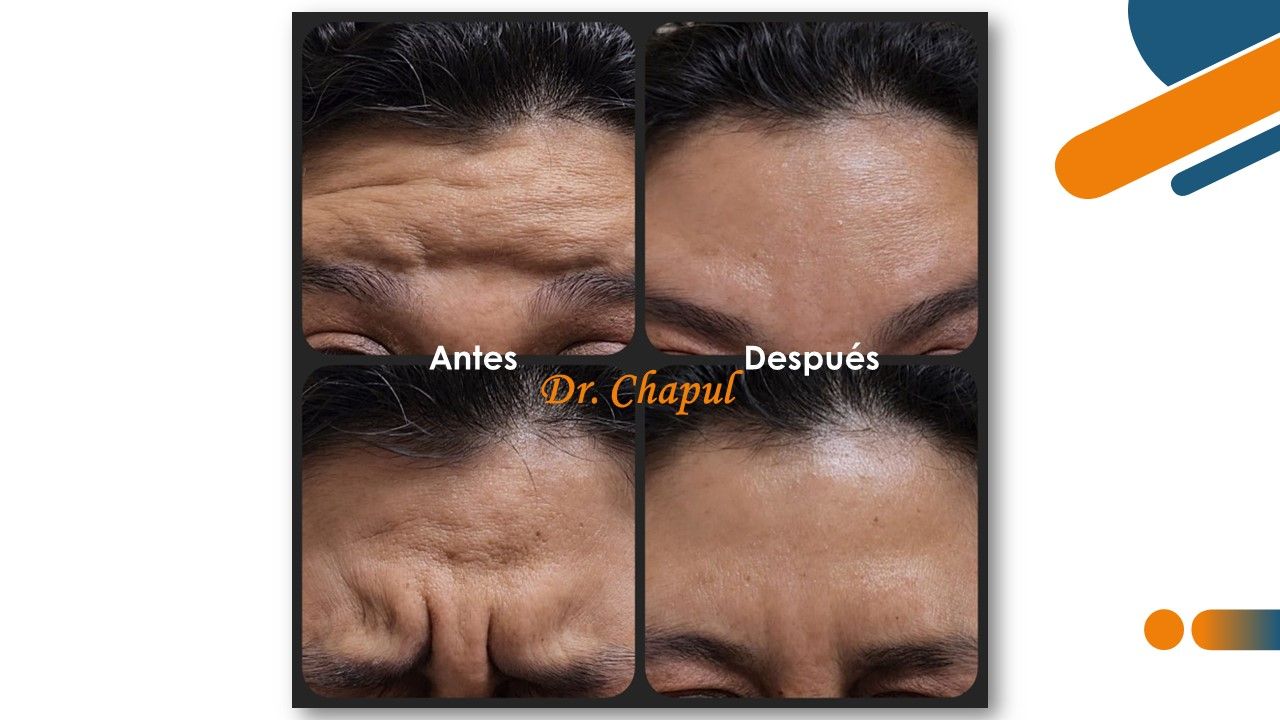 José Luis Muñoz Chapul-22