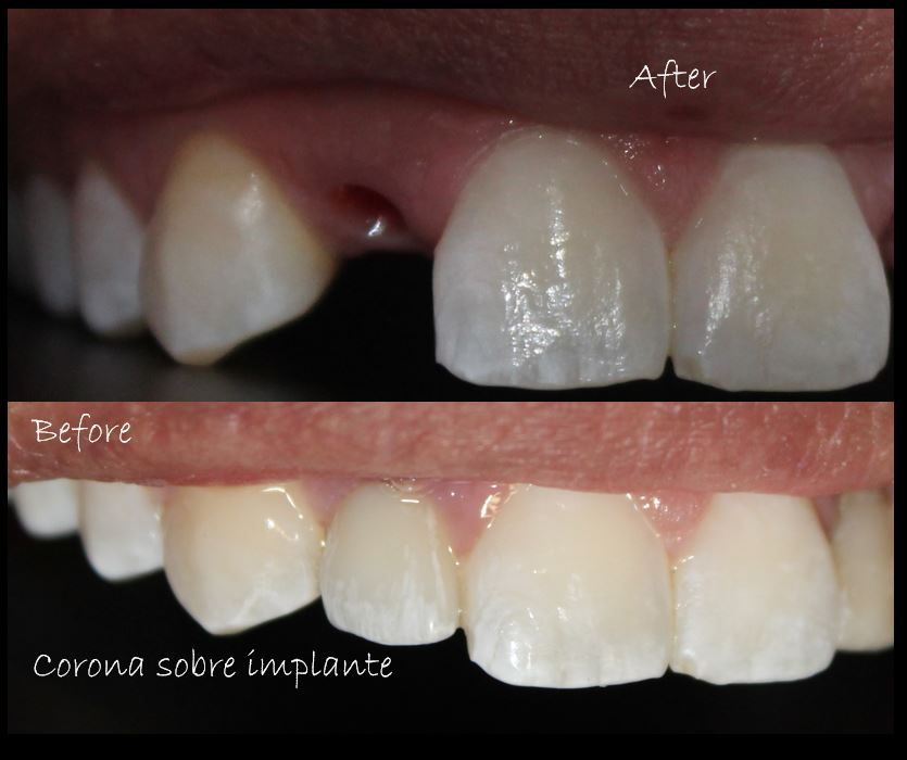 Aimee Valles Monárrez-28