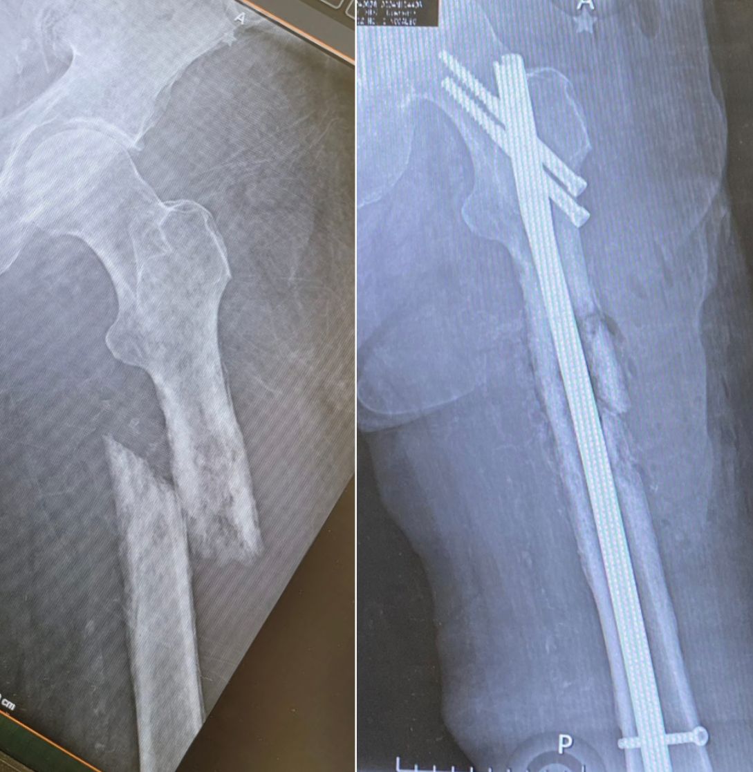 Diego Armando Contreras Rojas-14