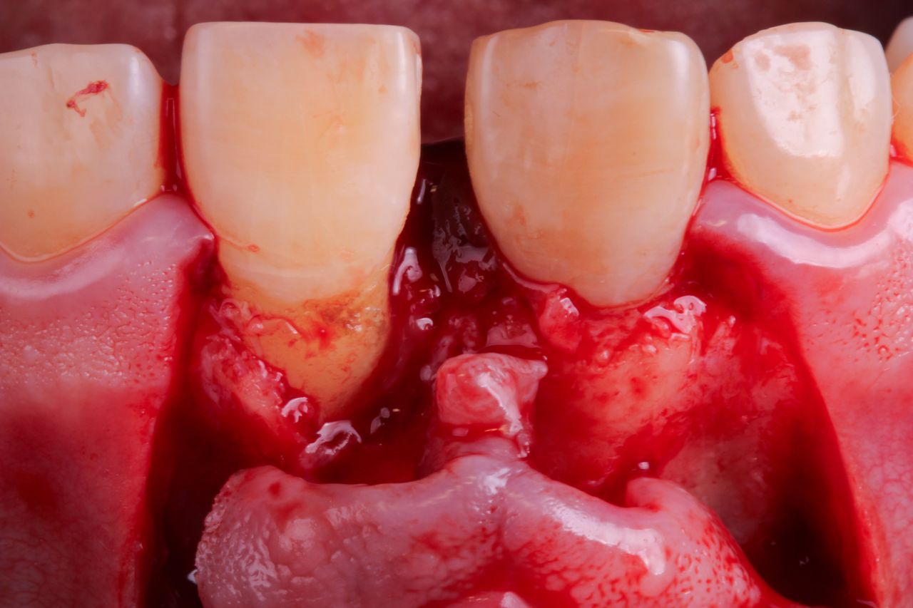 Hugo Enrique Aguilar Lamas-77