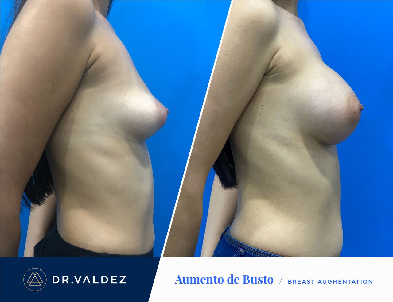 Pedro Arturo Valdez Gomez-28