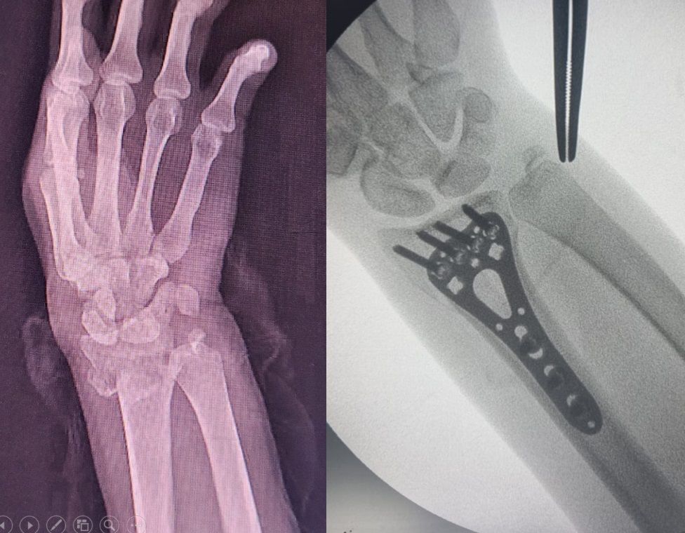 Luis Castañón Robles-5