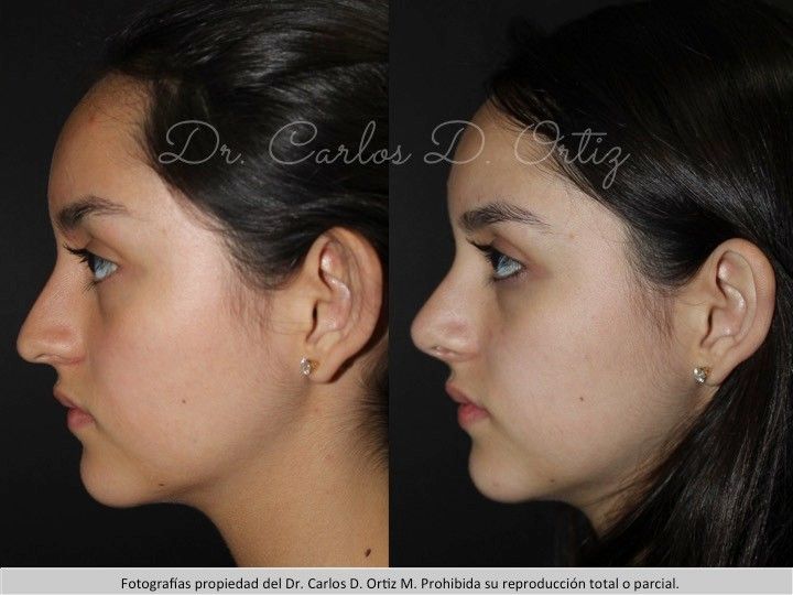 Carlos David Ortiz Moreno-49