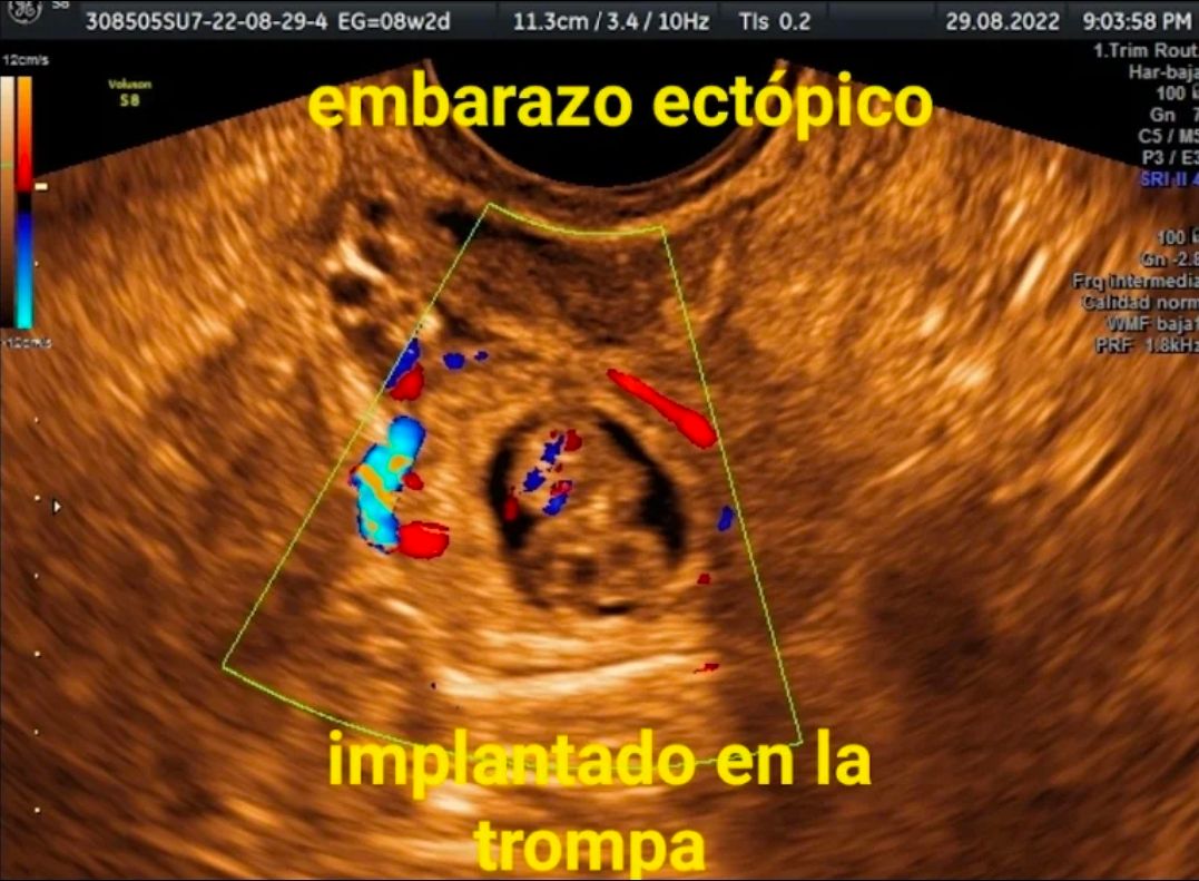 Juan Manuel Hernandez Campos-6
