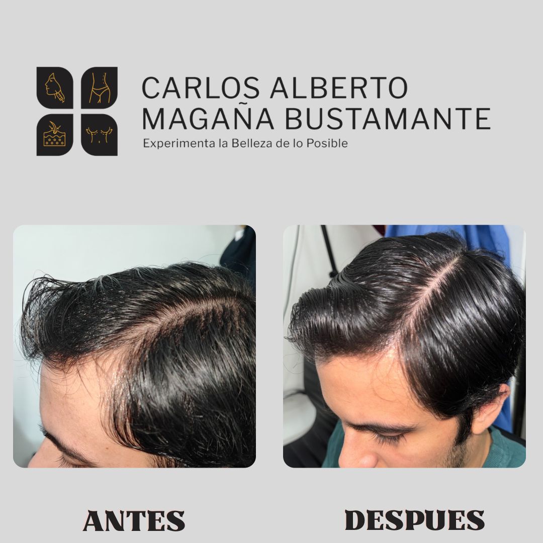Carlos Alberto Magaña Bustamante-43