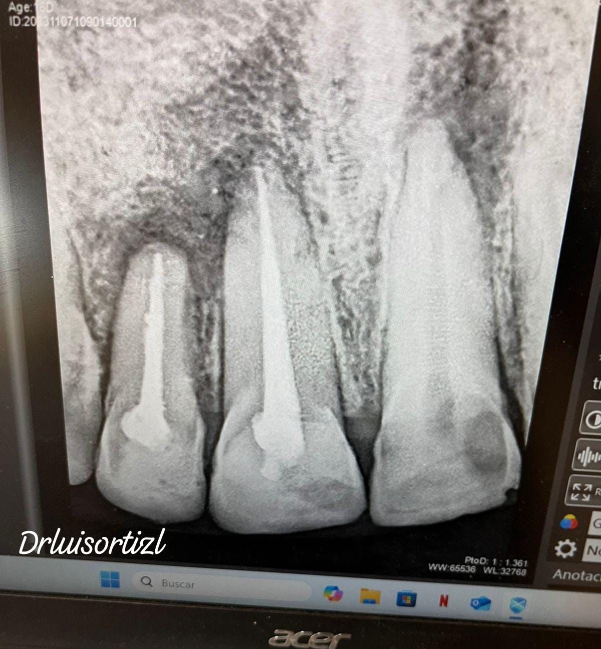 Luis Ángel Ortiz López-23