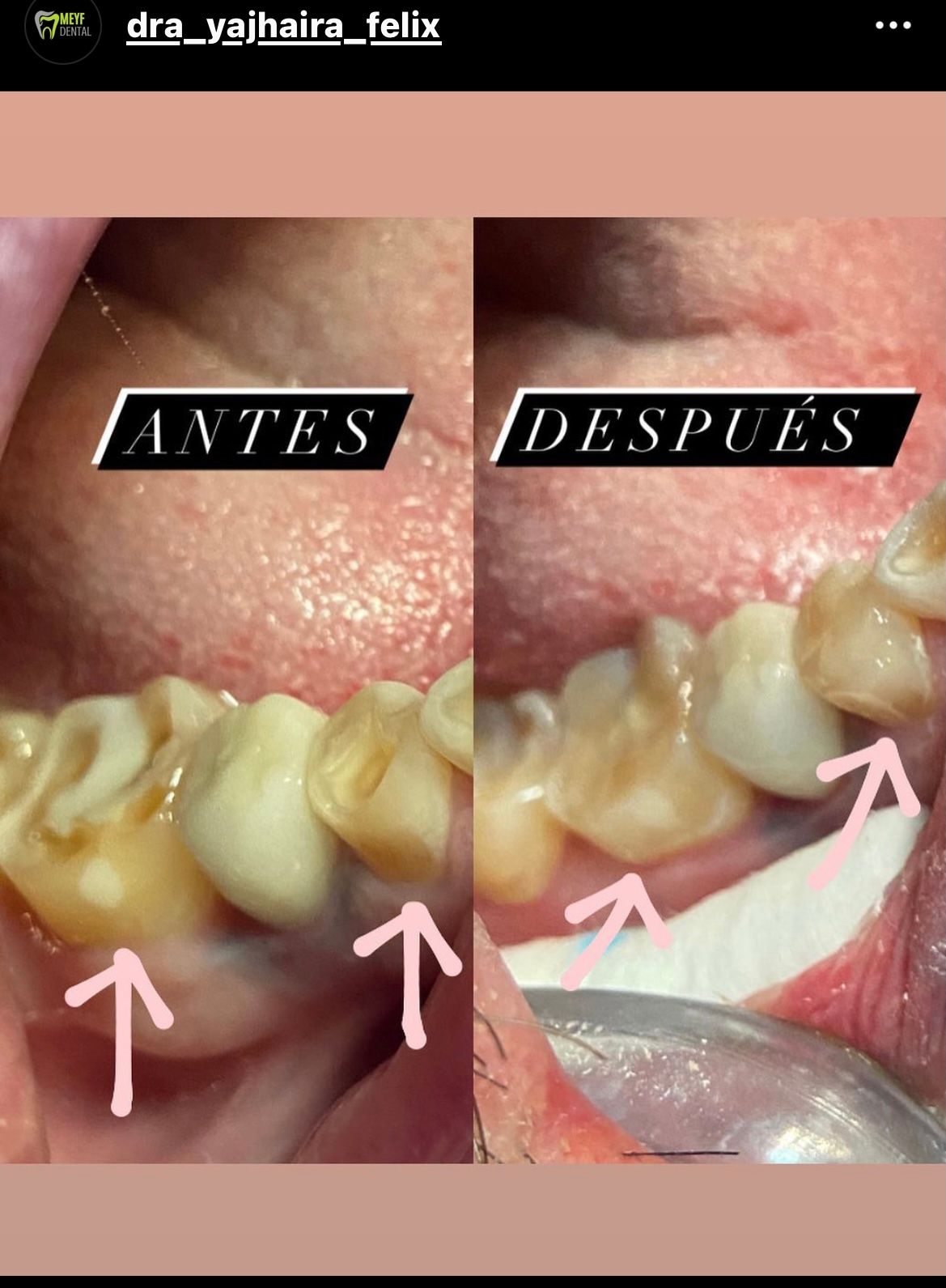 Yajhaira Estefania Félix Medina-4