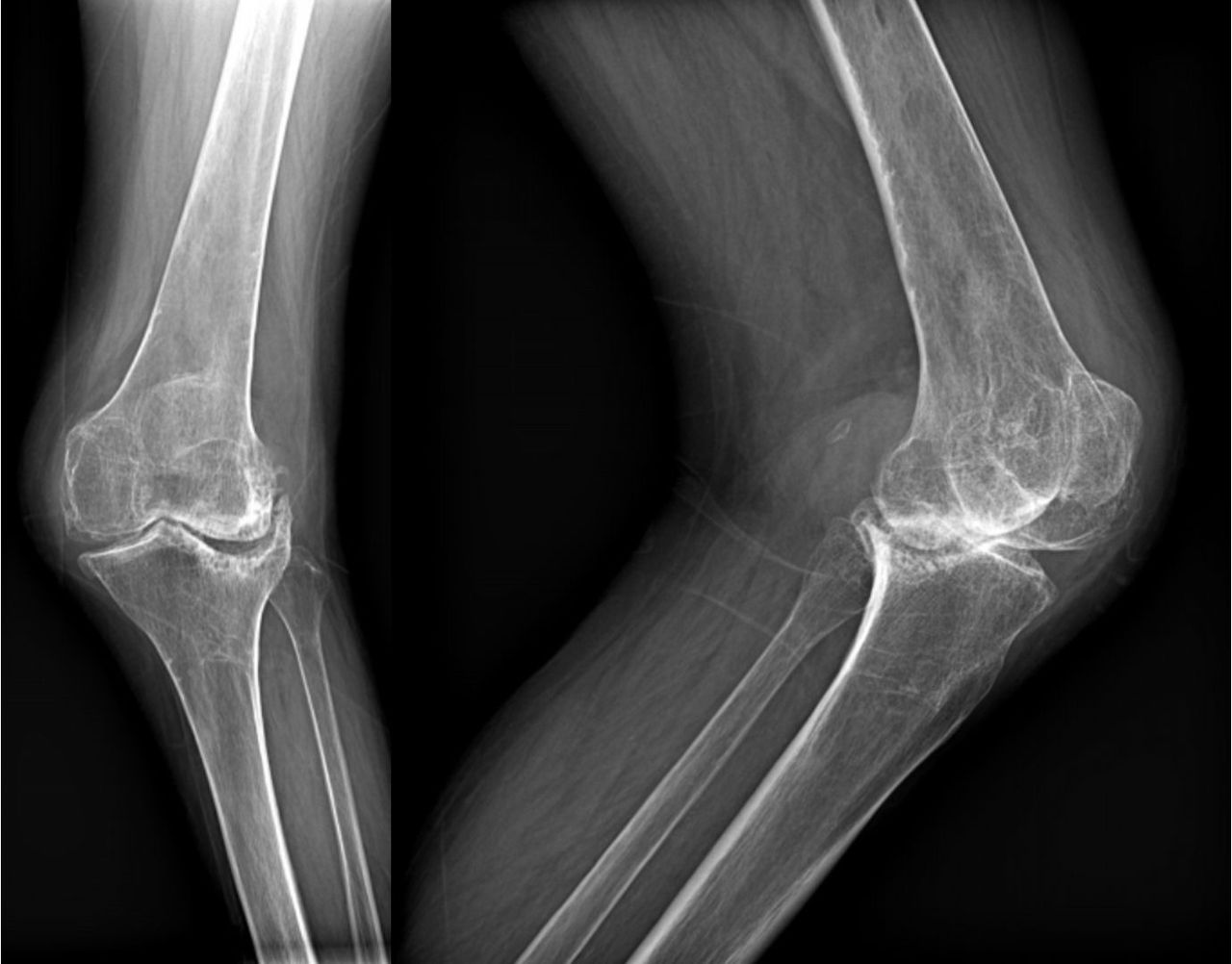 Alejandra Fuentes Martínez-10