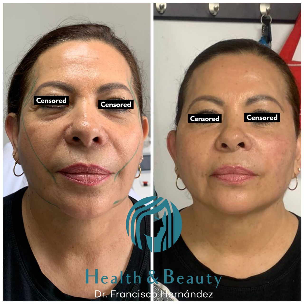 Francisco Hernández Gómez Crespo-87