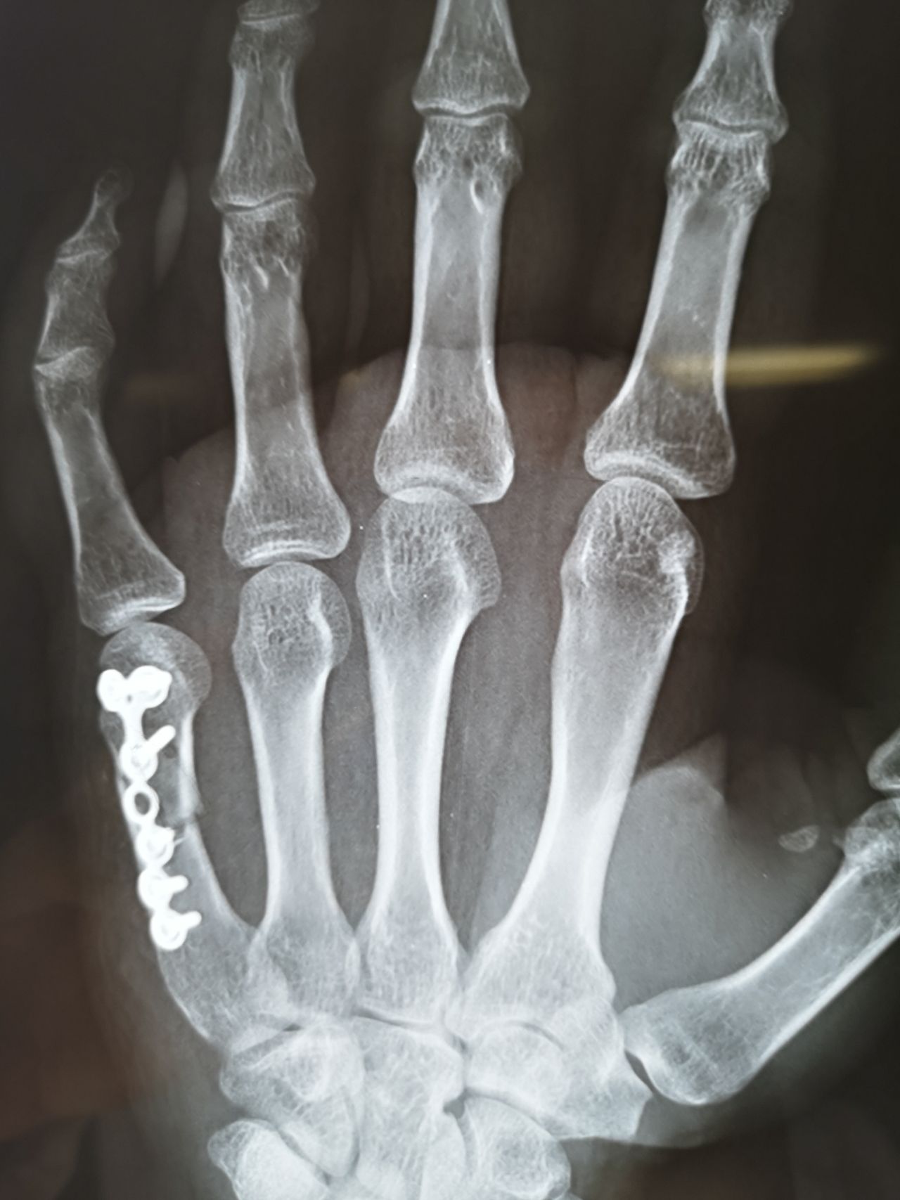 Manuel Ernesto Palma Palma-5