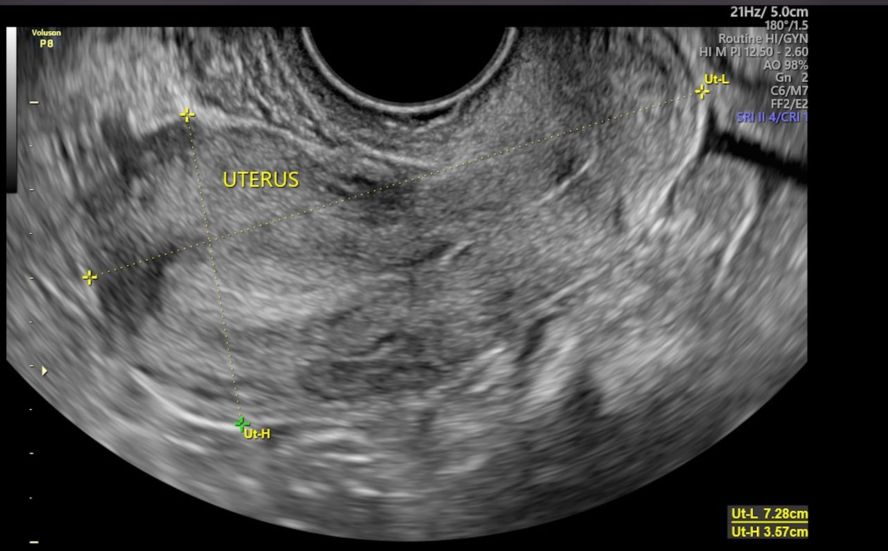 Dulce Anabel Jarquin Arango-26