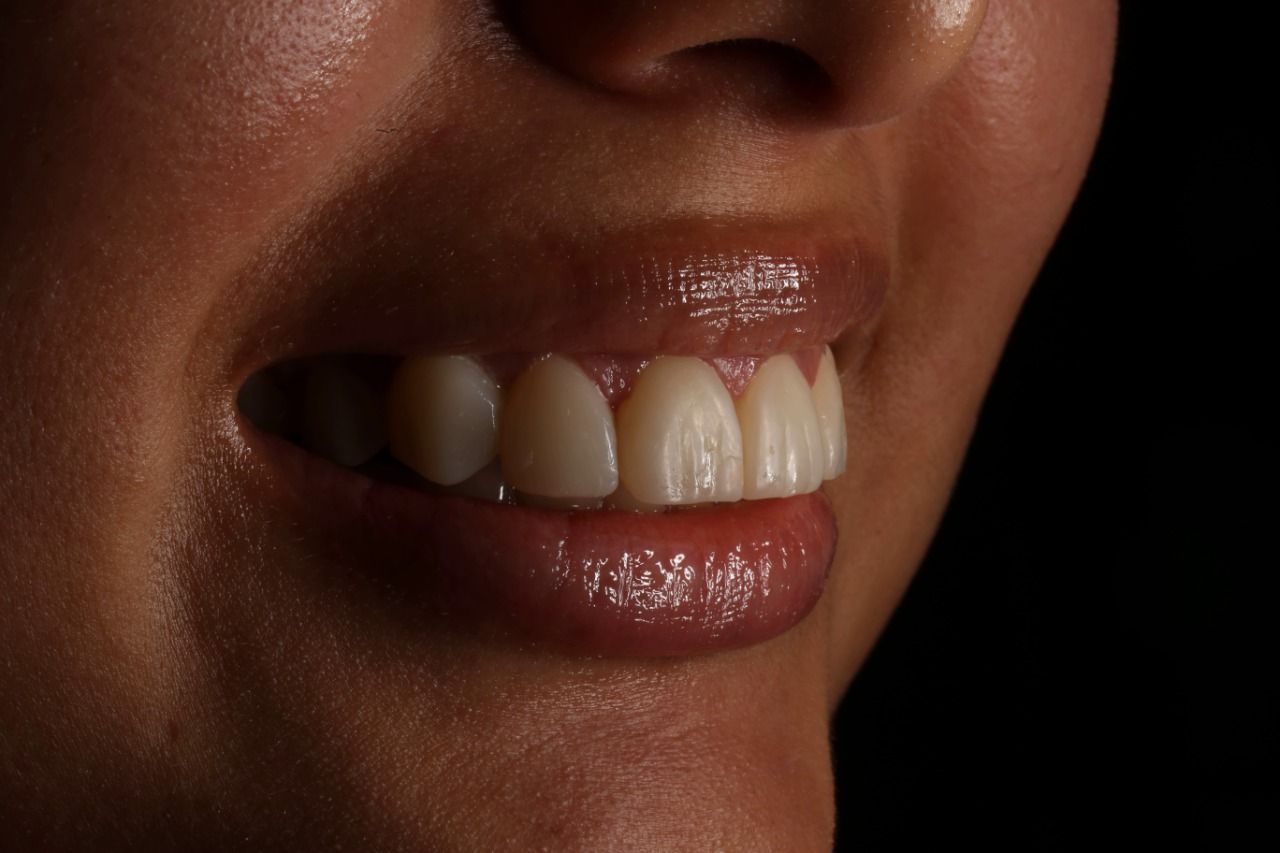 Oscar Alejandro Azcárate Tendilla-13