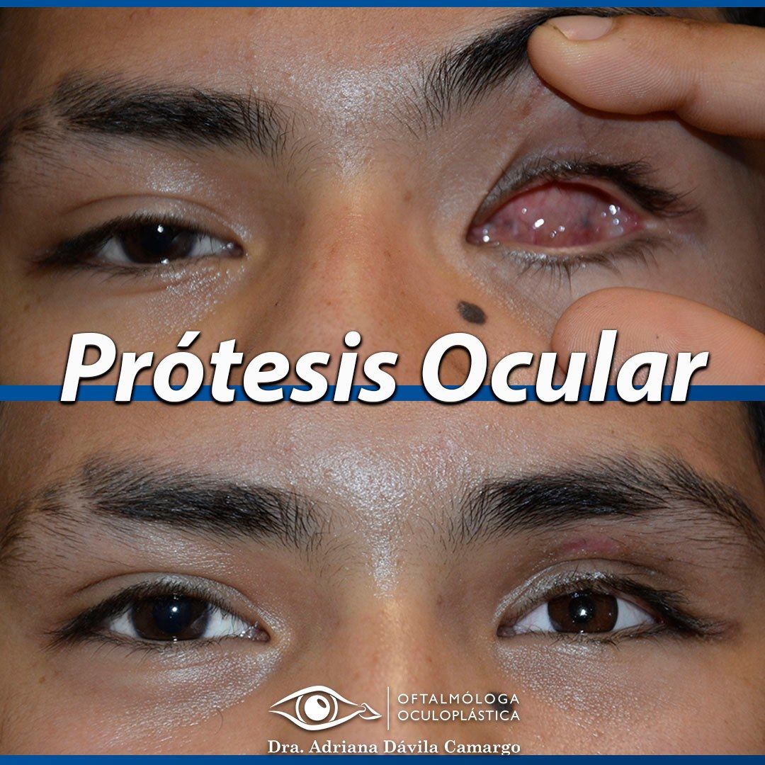 Adriana Davila Camargo-13