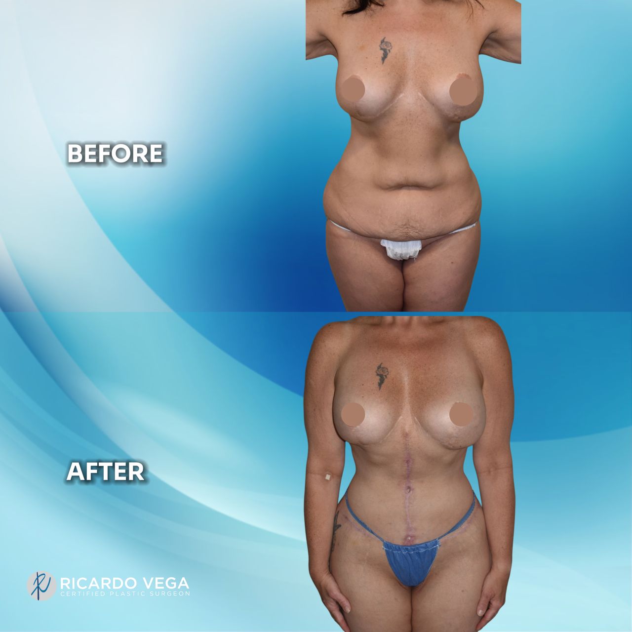 Ricardo Vega Montiel-11