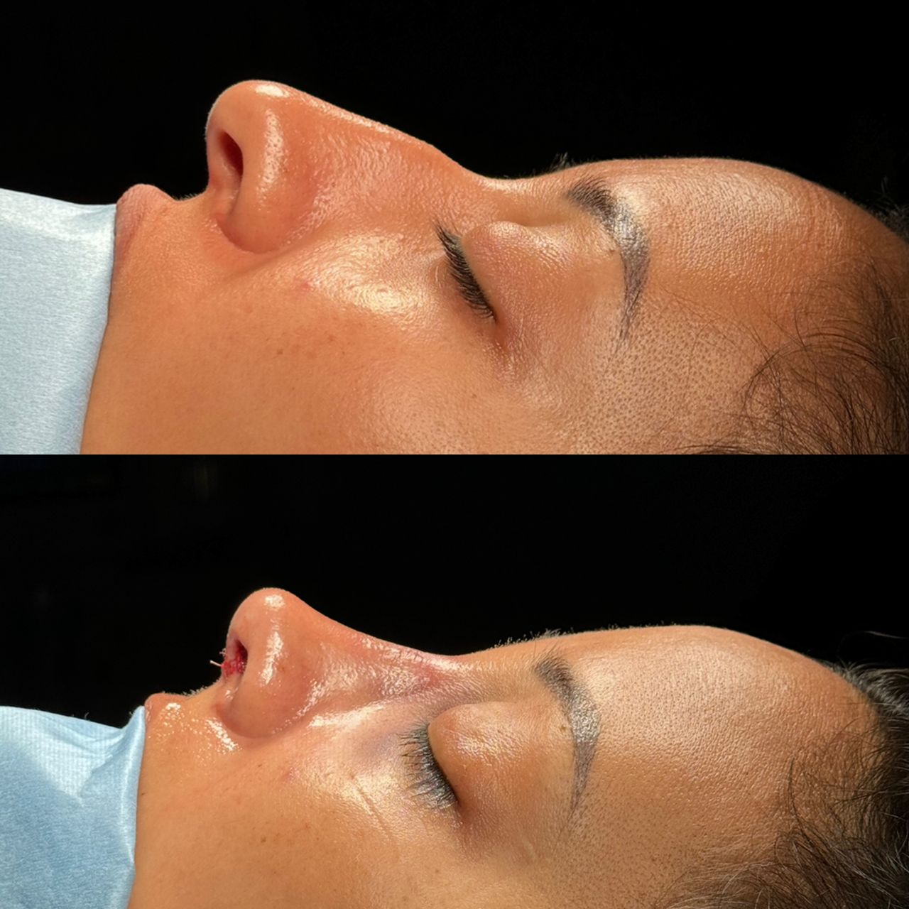 Angel Castro Urquizo-47