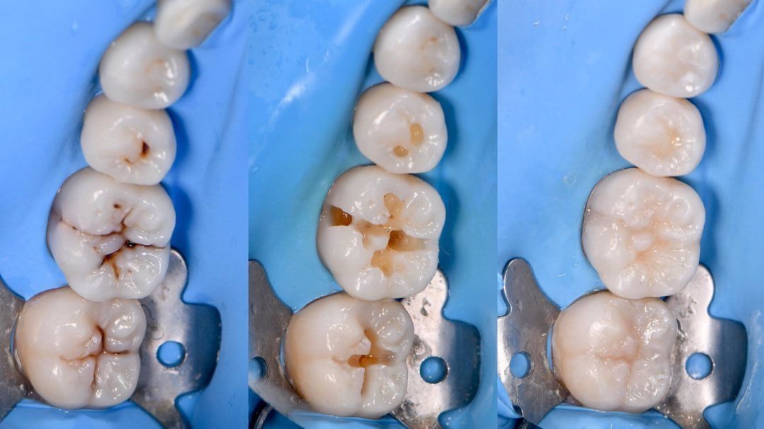 Ricardo López Lemus-70