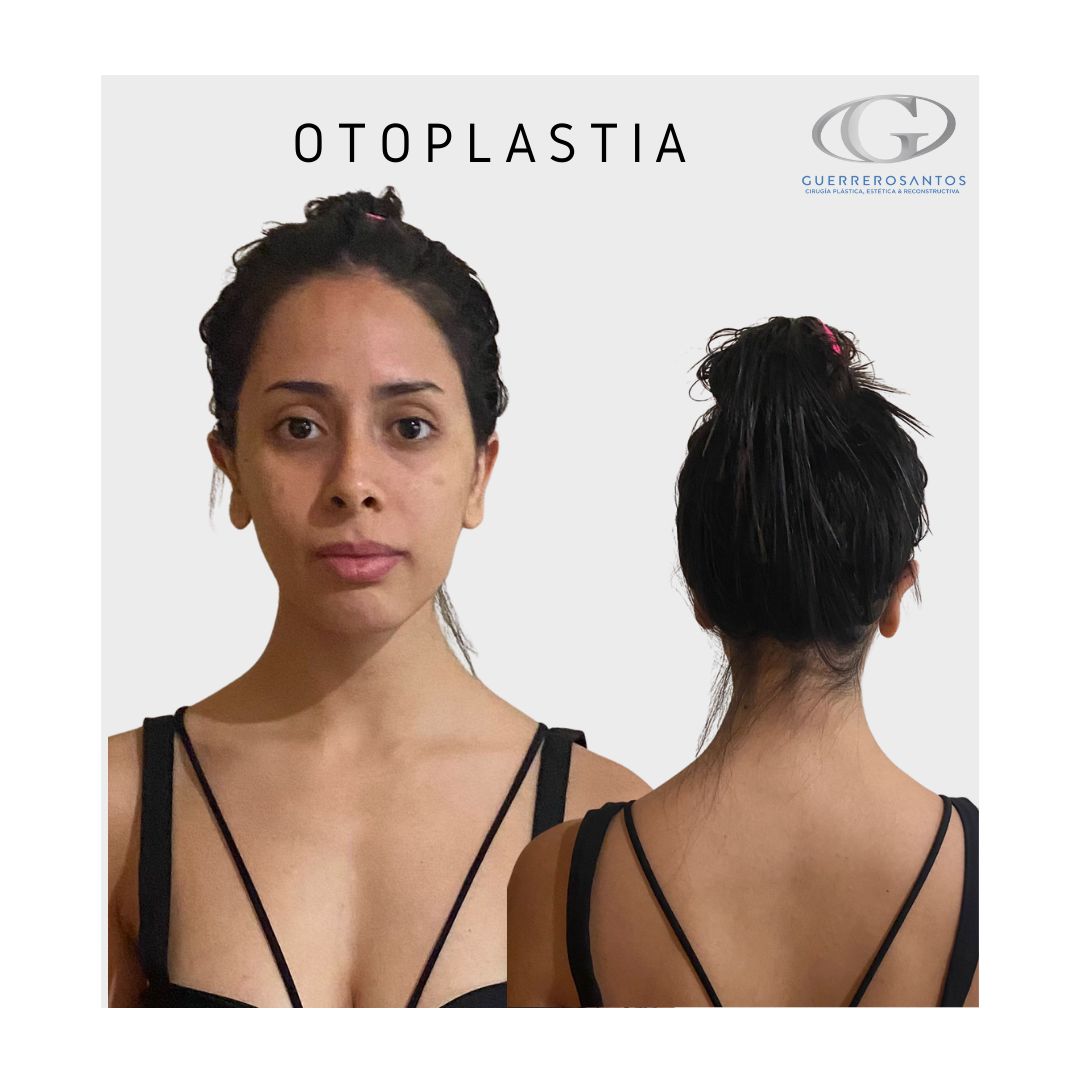 Fernando Guerrerosantos-11