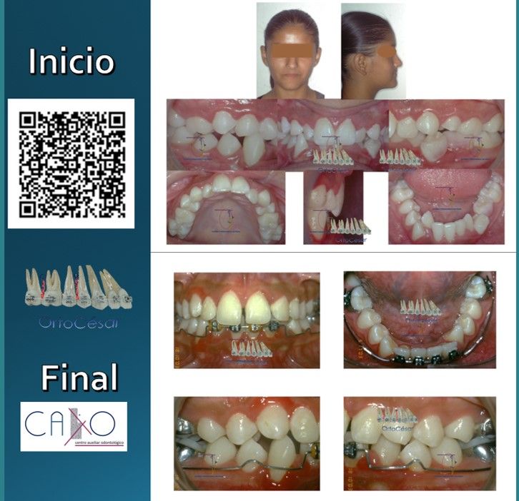 César Augusto Pérez Córdova-15