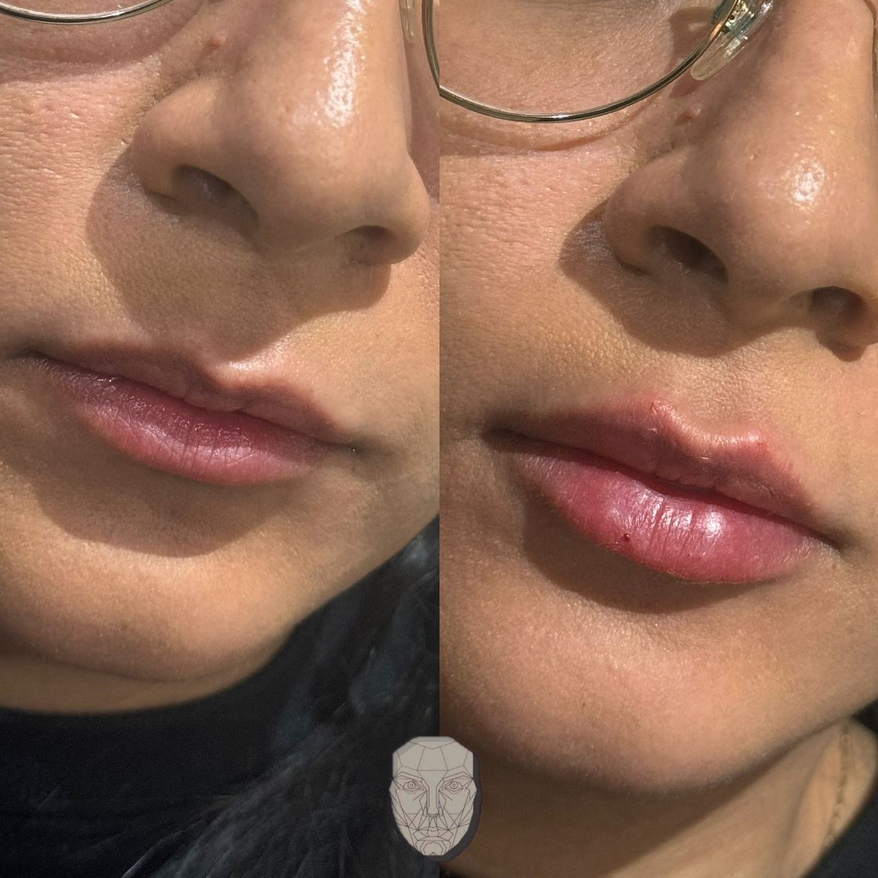 Anuar Hernández Flores-11