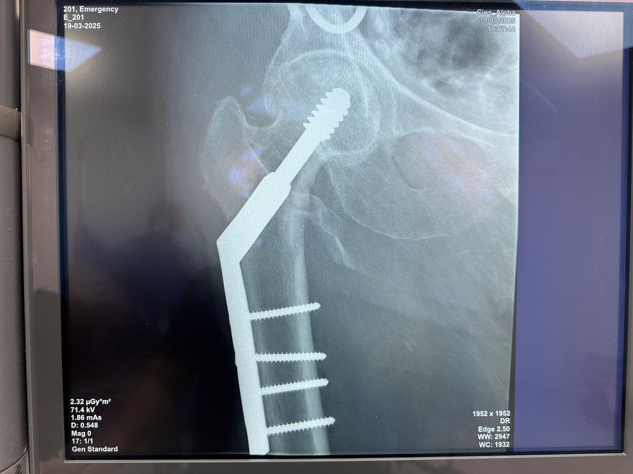 Emmanuel Benitez Biebrich-5