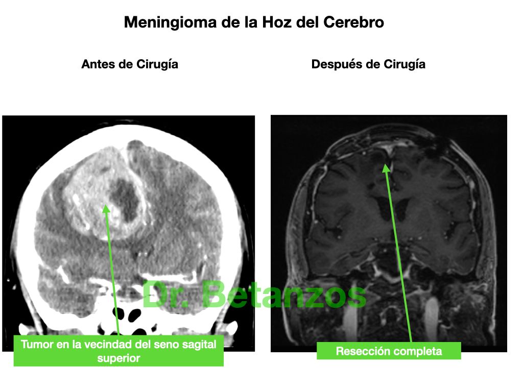 Aleixandre Betanzos Villegas-11