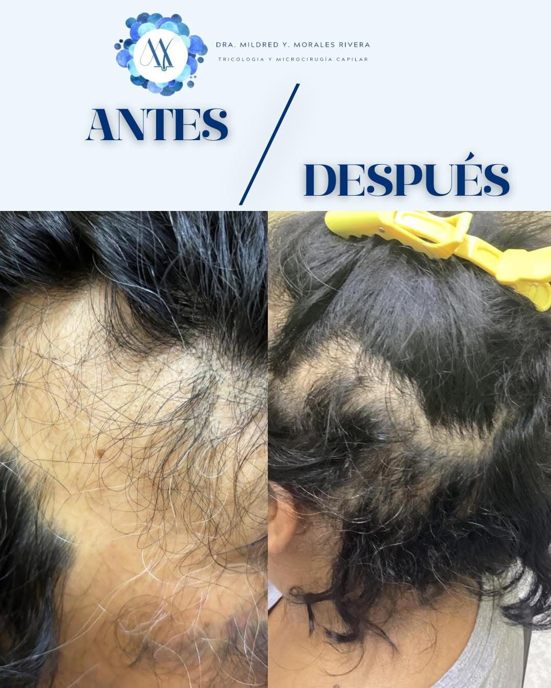 Mildred Yasmin Morales Rivera-4