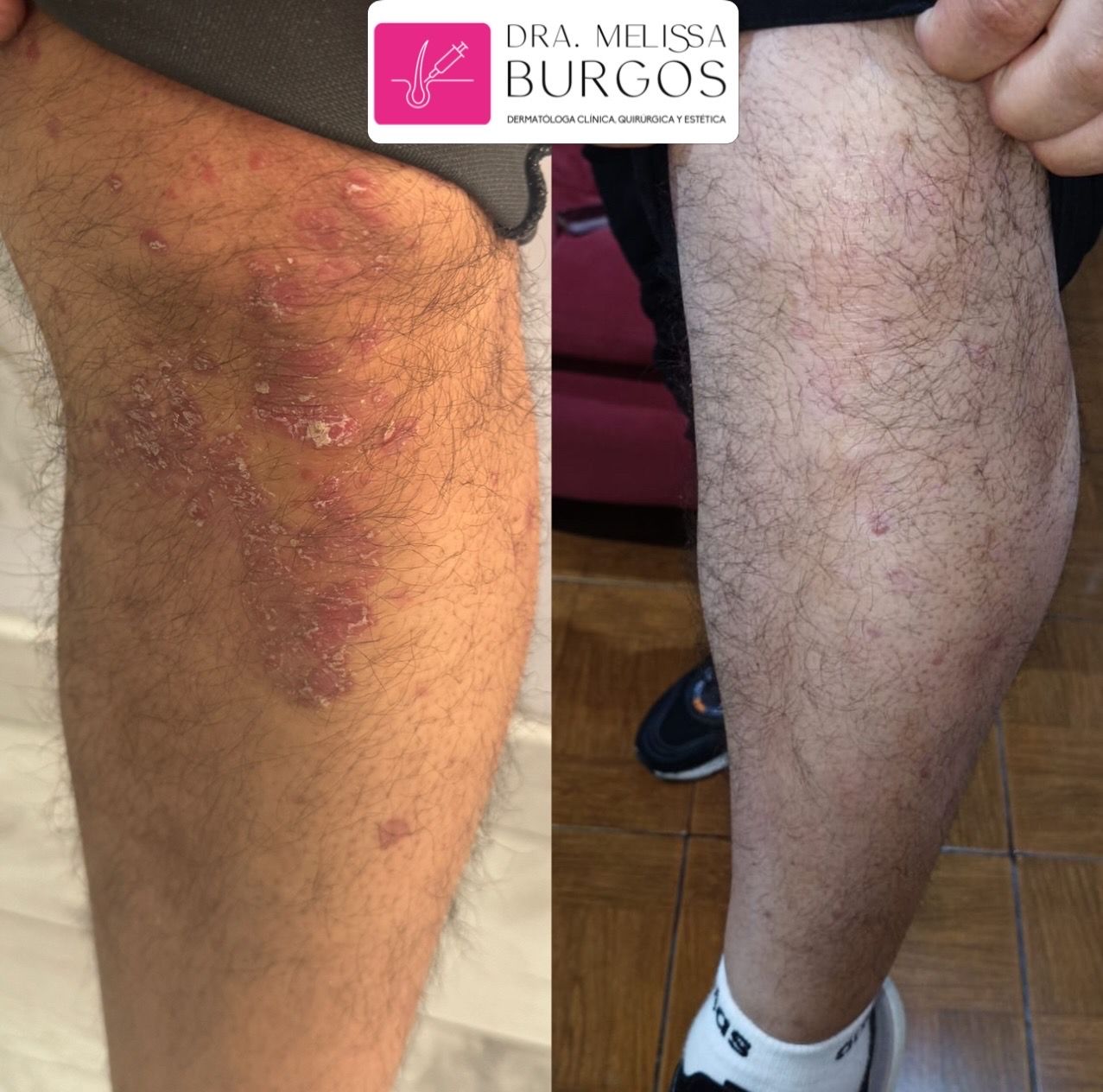 Melissa Burgos Romero-22