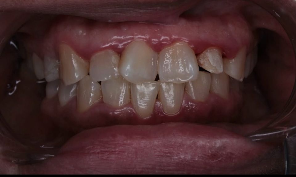 Carlos Enrique Hernández Rodríguez-15