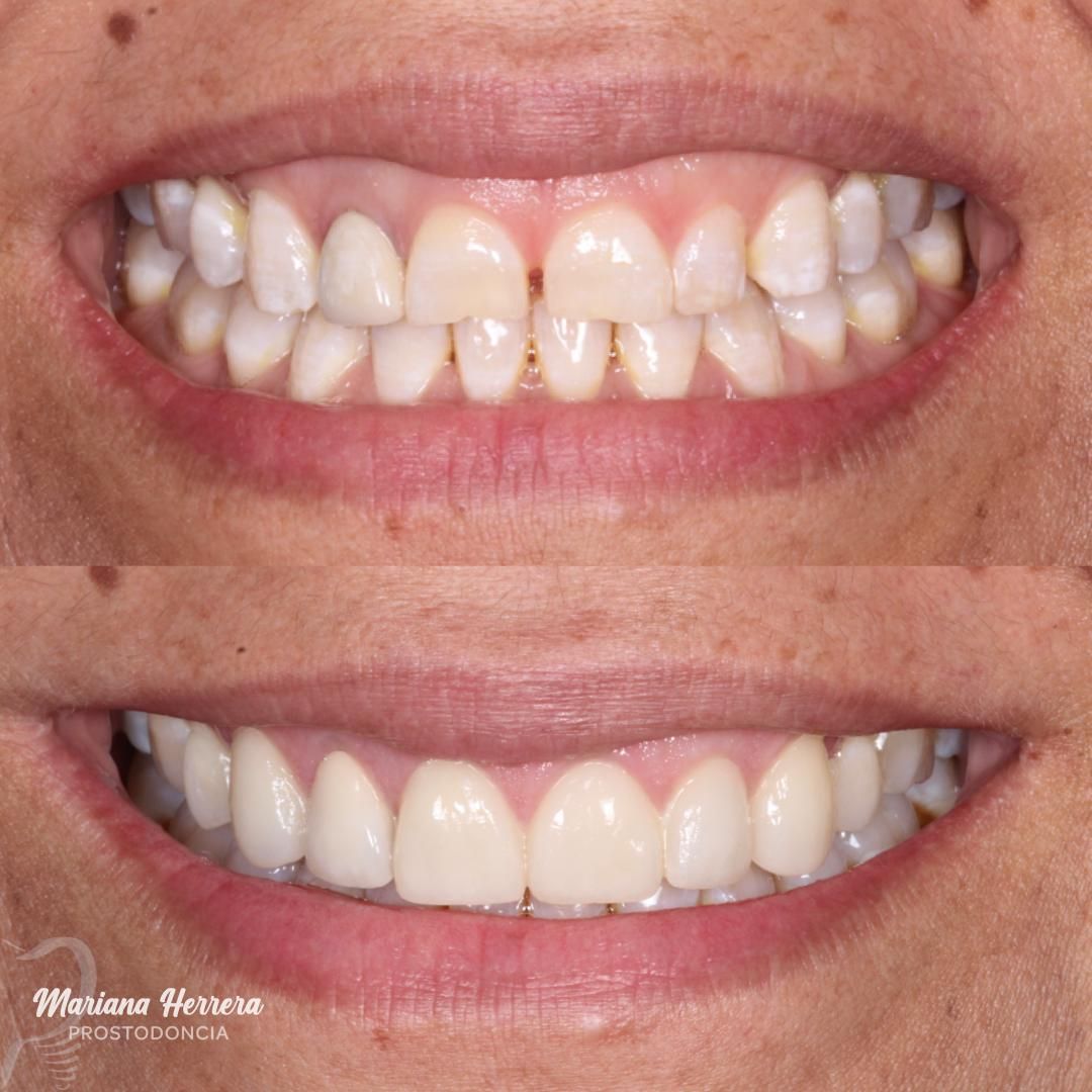 Mariana Herrera Martín Del Campo-9