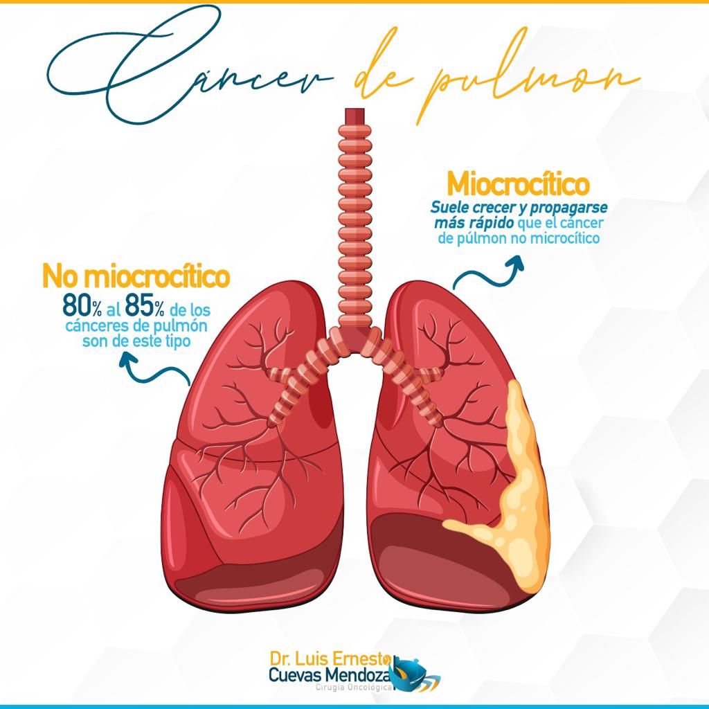 Luis Ernesto Cuevas Mendoza-250