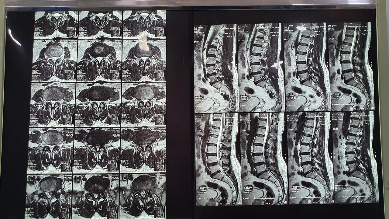 Sergio García Tenorio-37