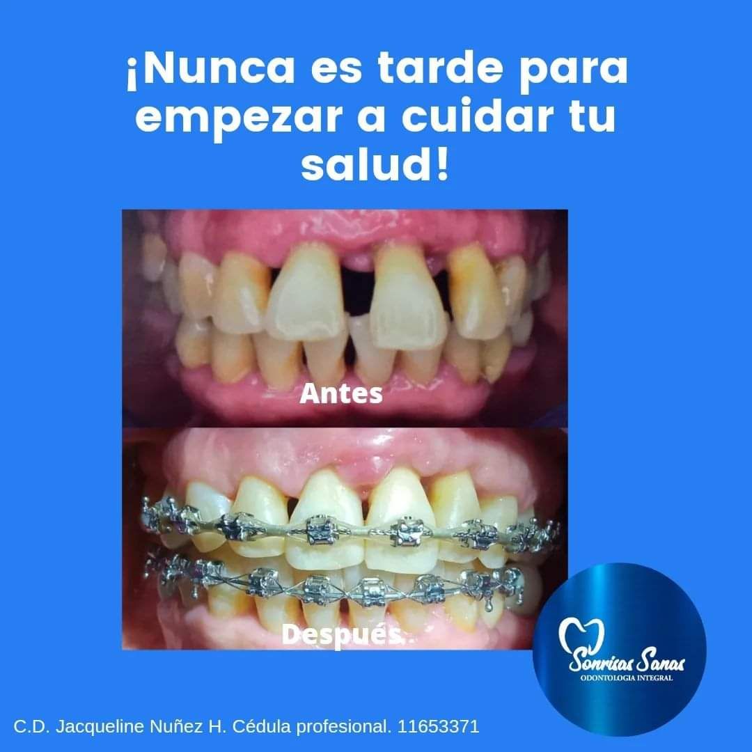 Jacqueline Nuñez Herrera-7