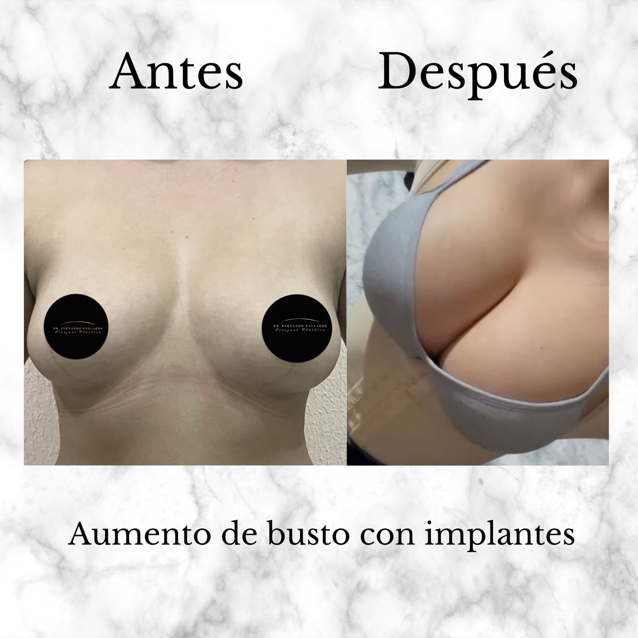 Fernando Gallardo-14