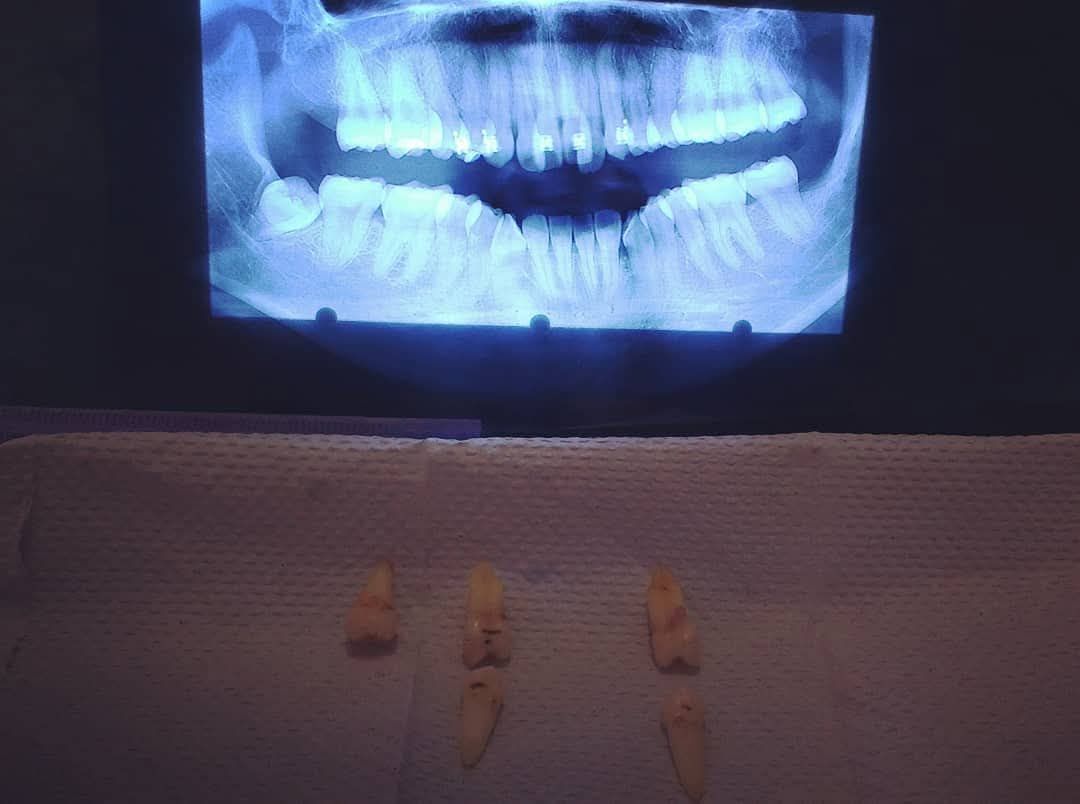 Leslie Michelle Galan Bahena-19