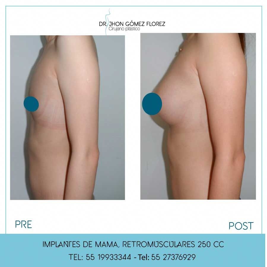 Jhon César Gómez Florez-17